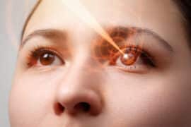 laser vision correction age