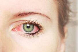 Close up of woman's irritated eye