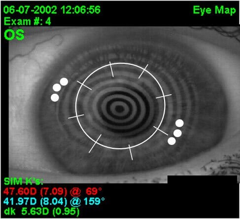 CK spots image