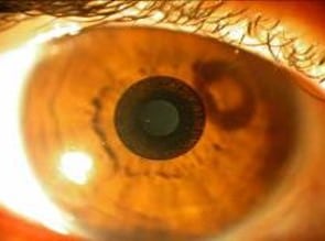 Eye closeup